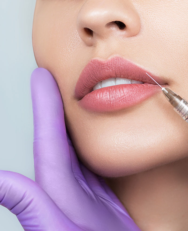 Dermal Fillers in New Canaan