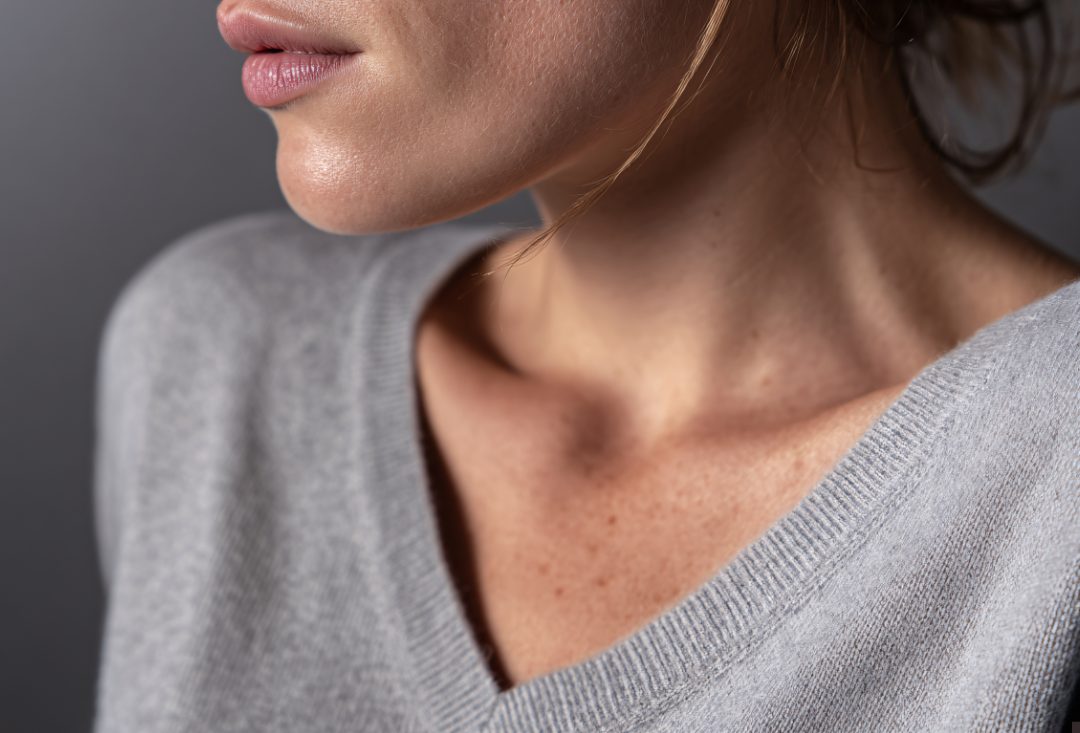 kybella